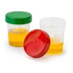 Specimen Cups, Non-Sterile, Full Turn, Green Cap, 120mL, 500 Cups