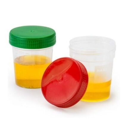 Specimen Cups, Non-Sterile, Full Turn, Green Cap, 120mL, 500 Cups